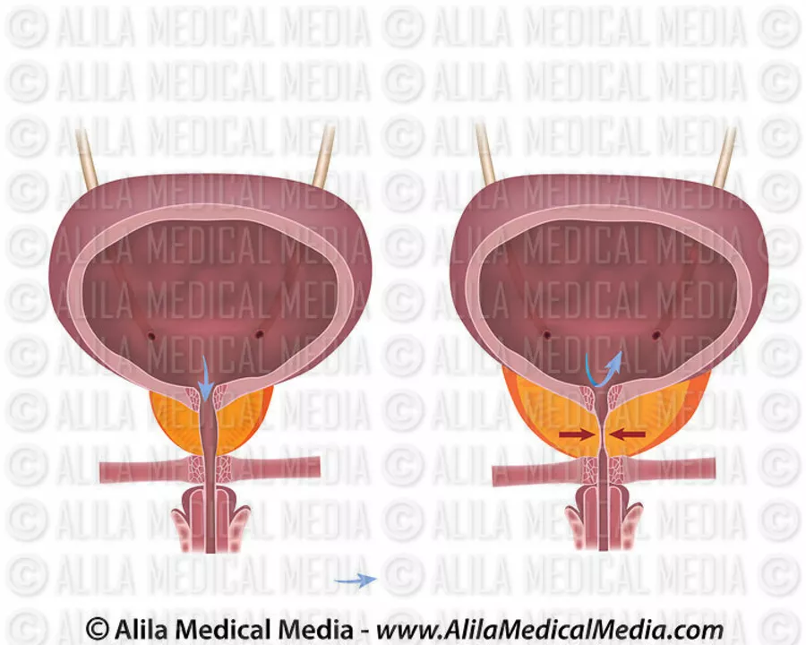 How to Talk to Your Doctor About Tolterodine