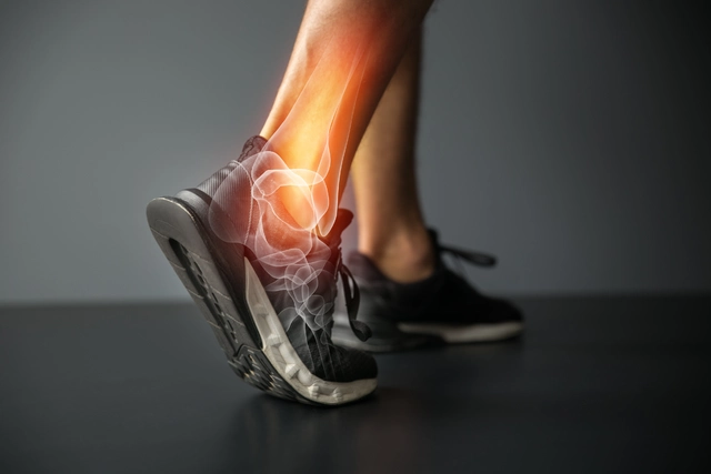 How to Choose the Right Shoes to Prevent Tendonitis